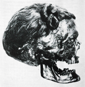 The head of Osterby Man, showing the Suebian Knot tied into his hair – a sign of his high status.
